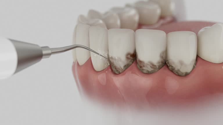Reliable Dental Implants contractor in Dubach, LA by Smile Center Dentistry